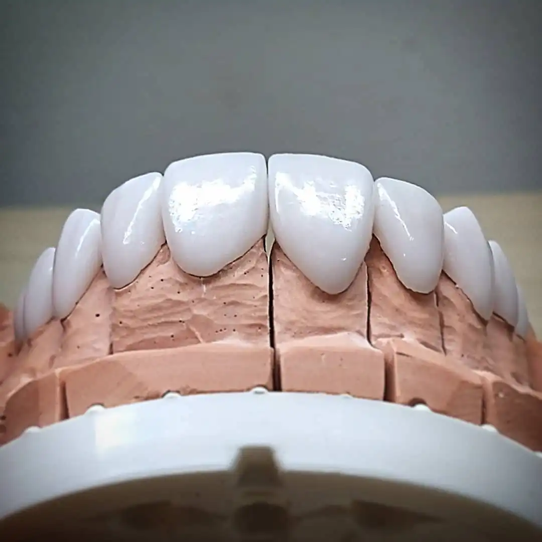 protese dental