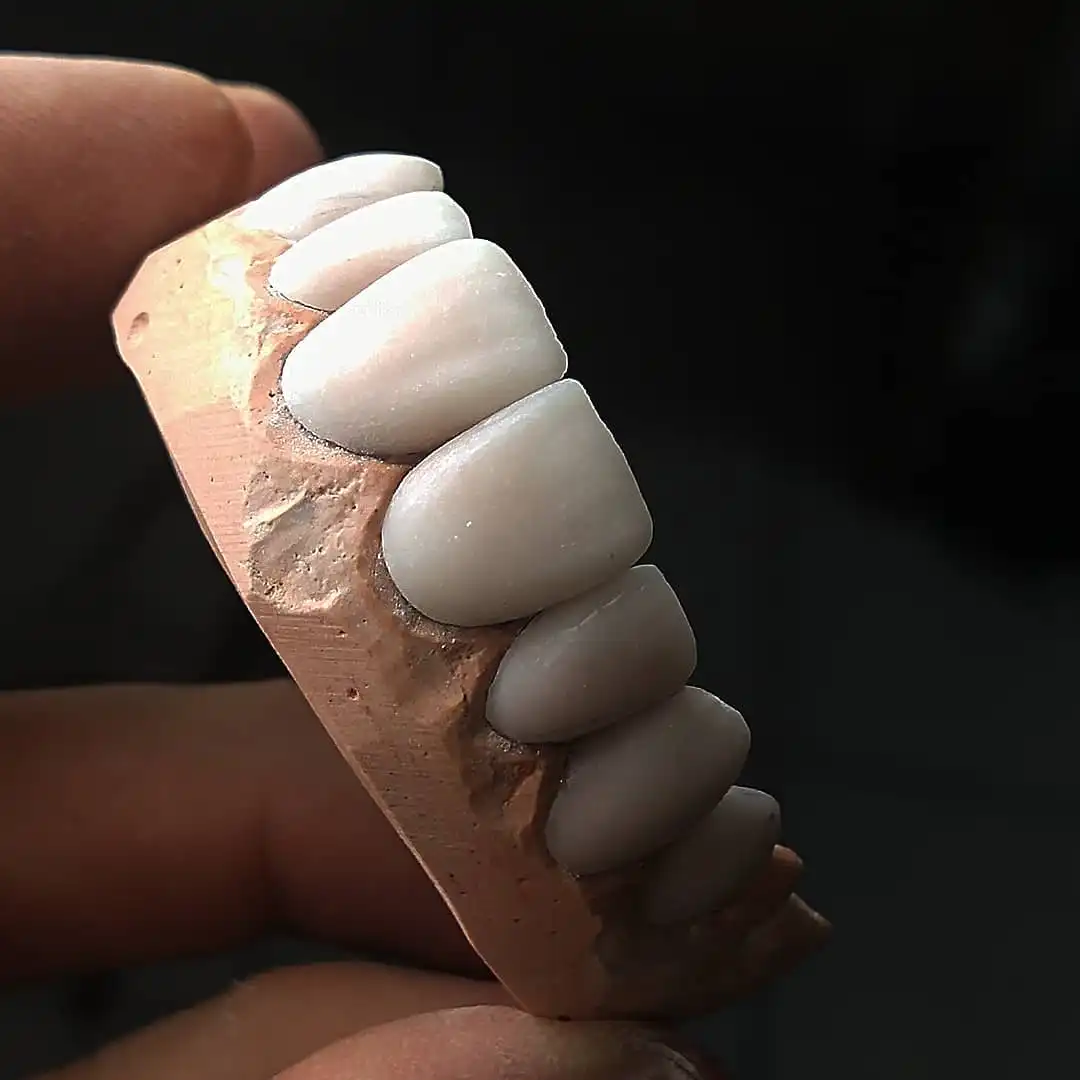 protetico dental